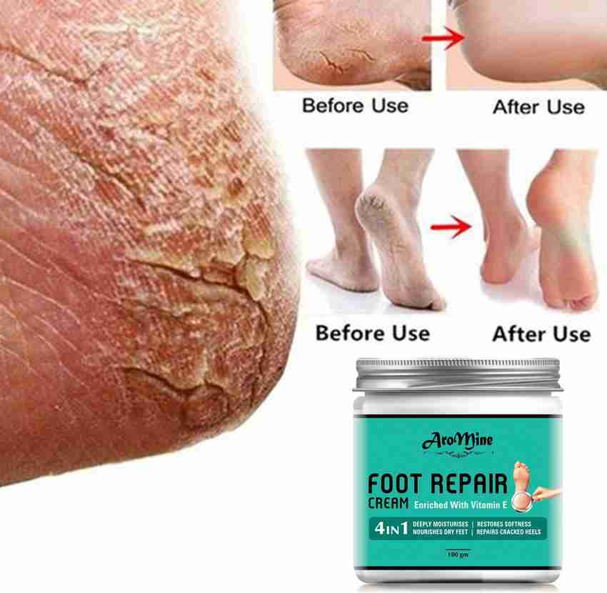 Foot crack treatment home in tamil deals