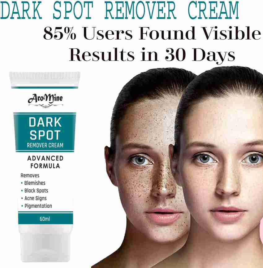 Pimple dark spot removal cream new arrivals