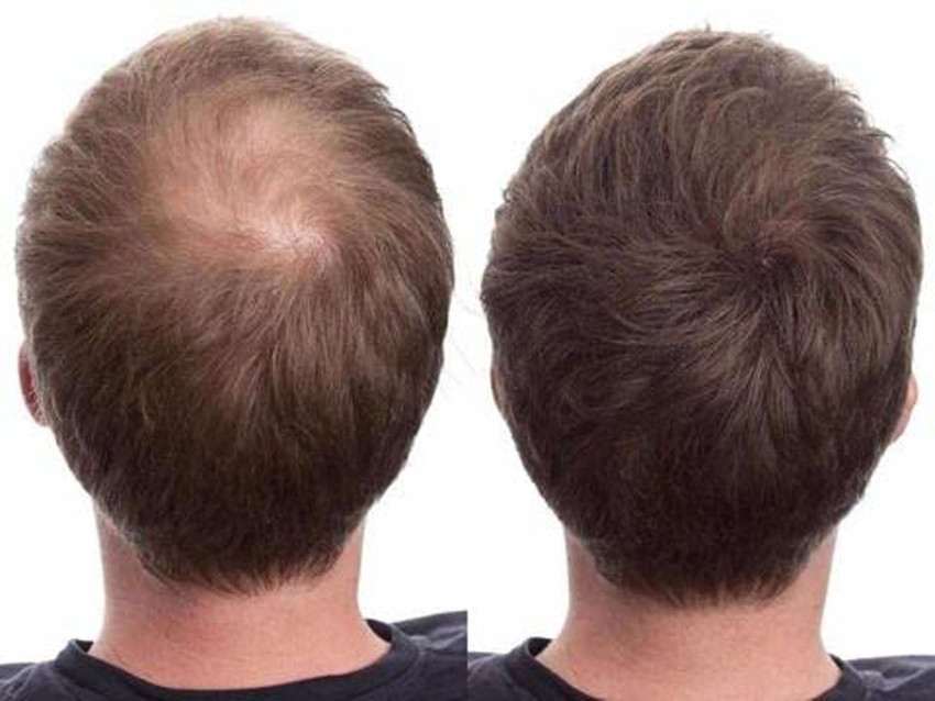 Caboki hair sale