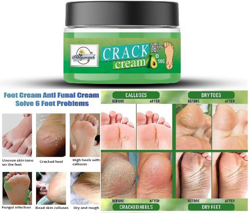 Heel on sale crack remover