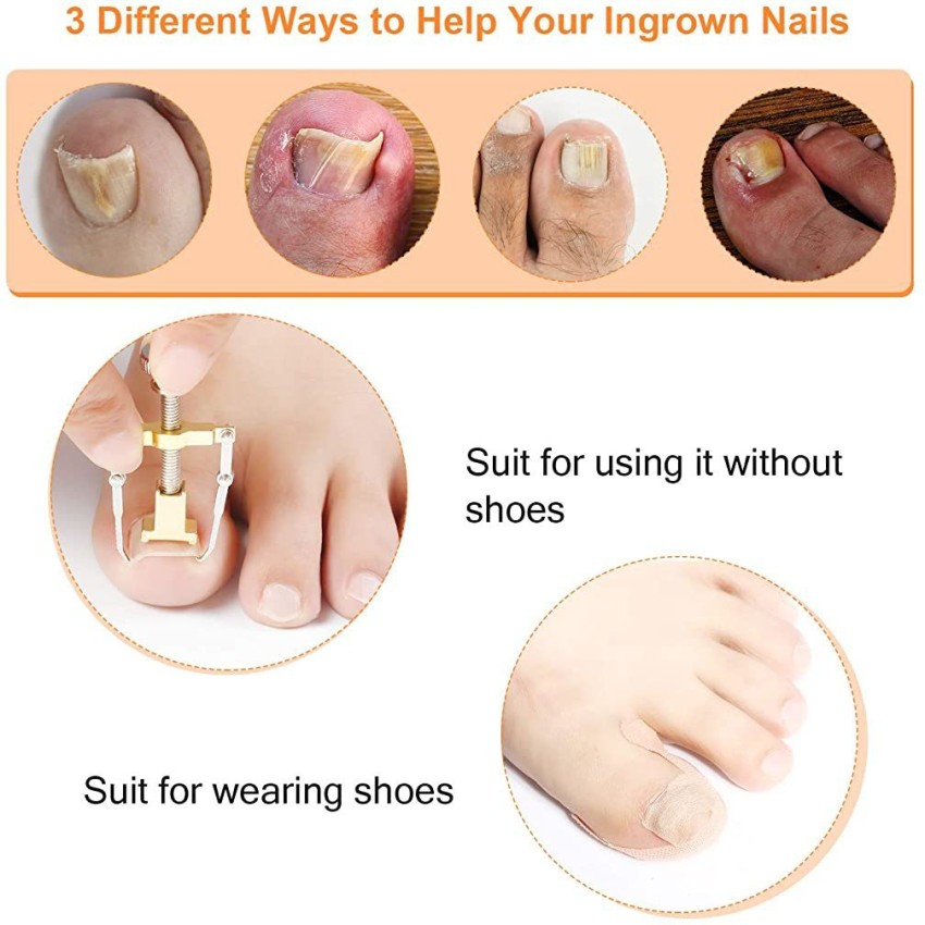 https://rukminim2.flixcart.com/image/850/1000/l4n2oi80/nail-clipper-cutter/o/r/j/ingrown-toenail-treatment-tool-kit-8-pieces-ingrown-toenail-original-imagfhukntacbumj.jpeg?q=90