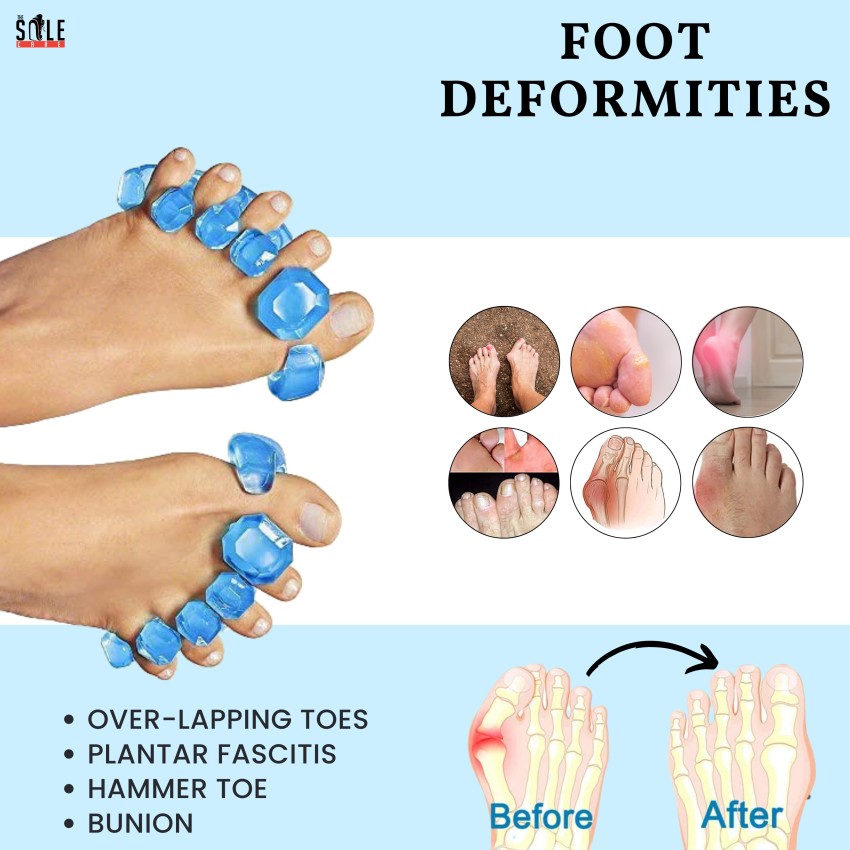 Store Royalkart - If you are suffering from Bunions