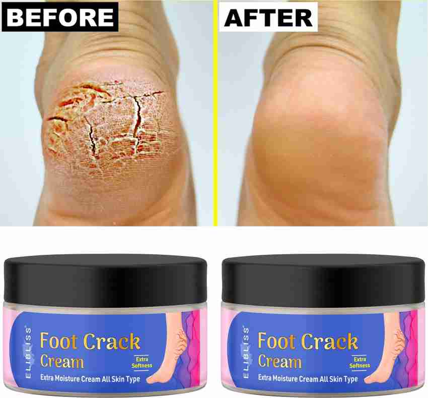 Best foot cream sales for peeling feet