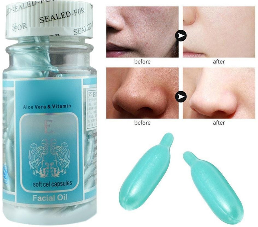 Vitamin e for acne scars hotsell