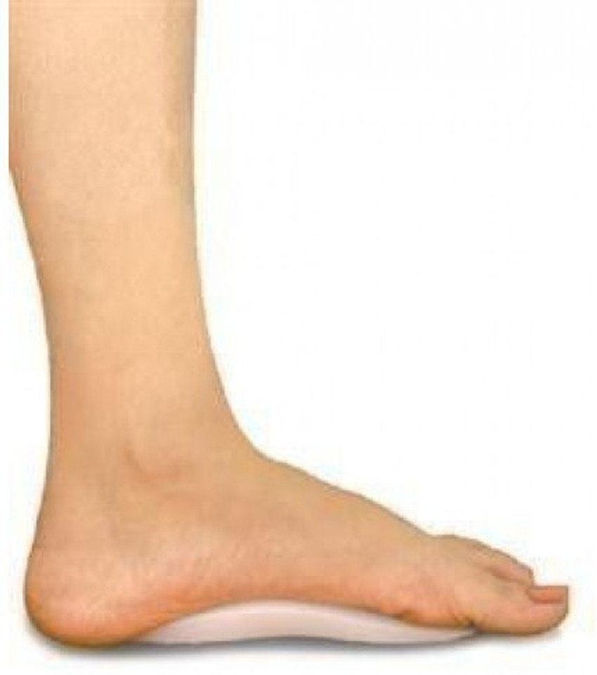 Tynor sale flat foot