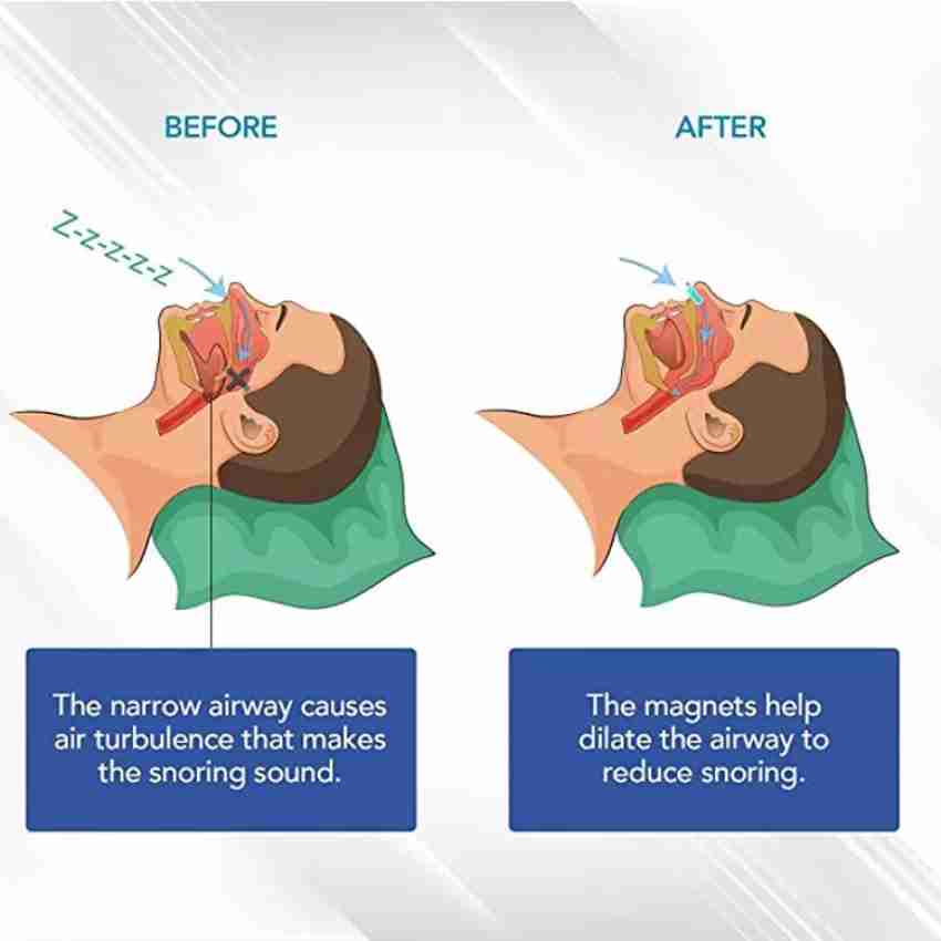 Digital Shoppy Better Breath Anti Snore Nasal Strips Anti-snoring Device  Price in India - Buy Digital Shoppy Better Breath Anti Snore Nasal Strips  Anti-snoring Device online at