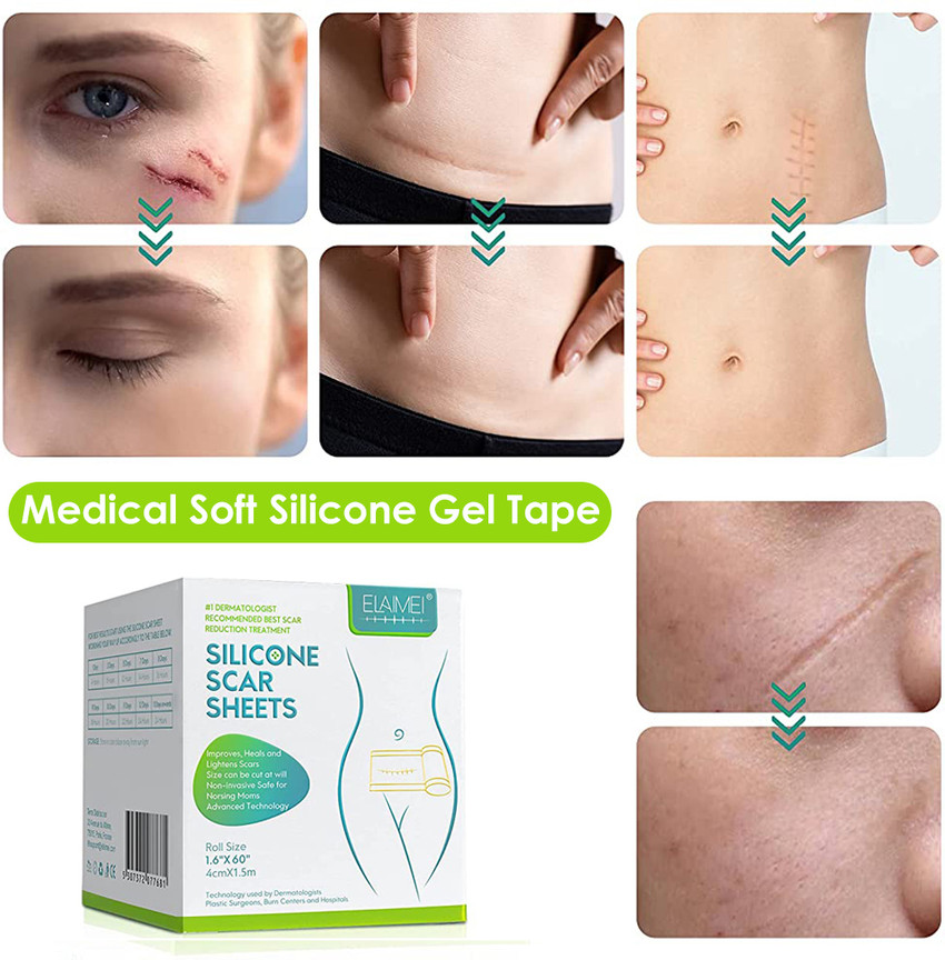 Scar reducing bandages outlet