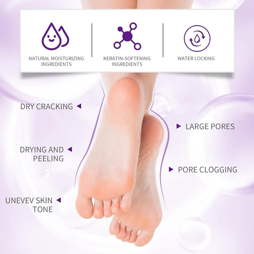 Foot fungus cracked skin online
