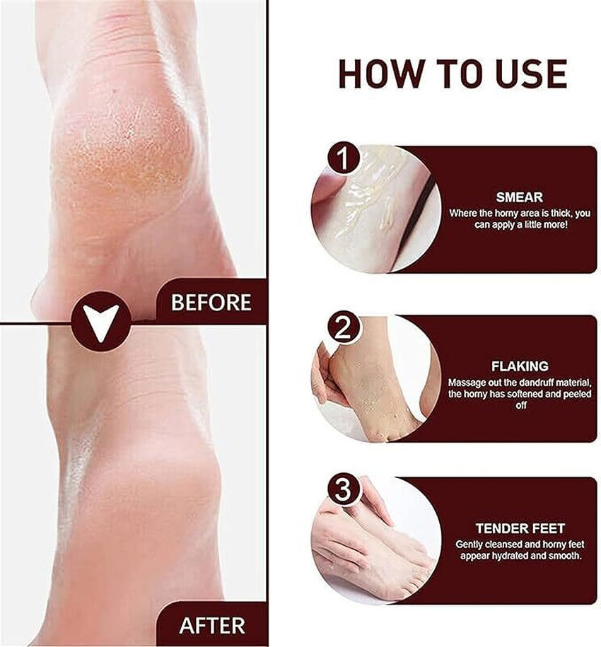 GoReady foot cream crack cream Smooth Foot Crack Cracked Heel Repair Foot Cream Price in India Buy GoReady foot cream crack cream Smooth Foot Crack Cracked Heel Repair Foot