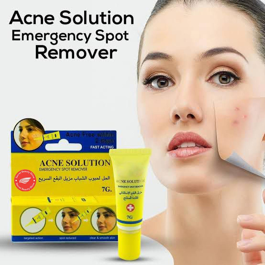 Acne solution hotsell