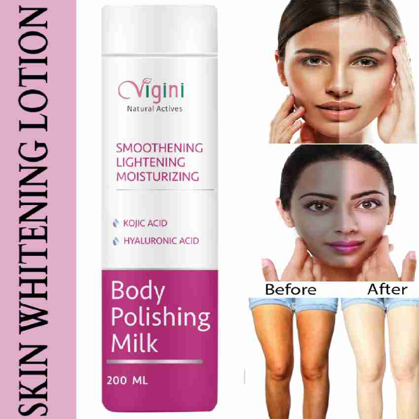 Vigini Skin Pigmentation Removal Whitening Lightening Fairness