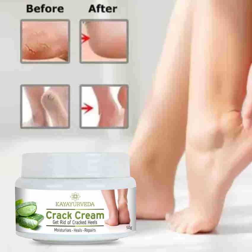Best foot crack cream quora online