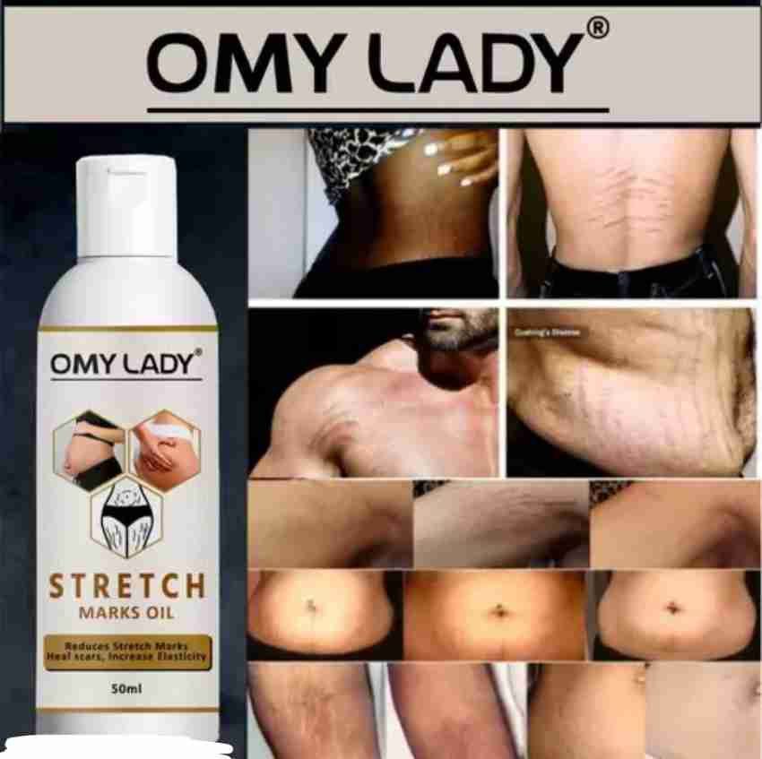 Omy Lady Stretch Marks Removal Oil For Women Men