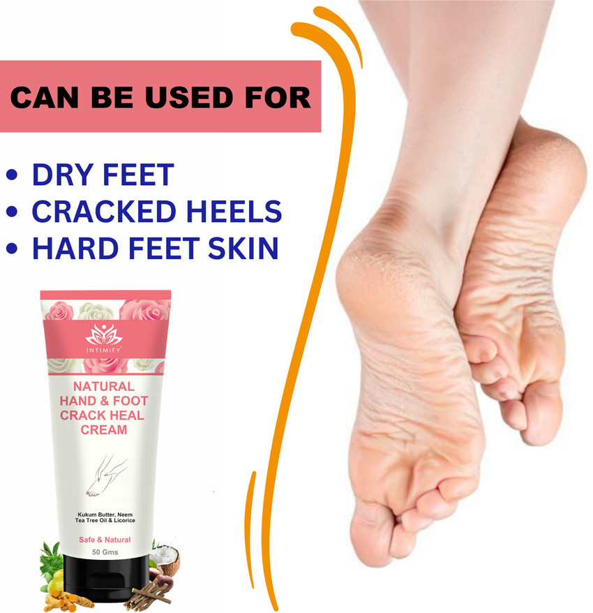 Leg crack removal cream online