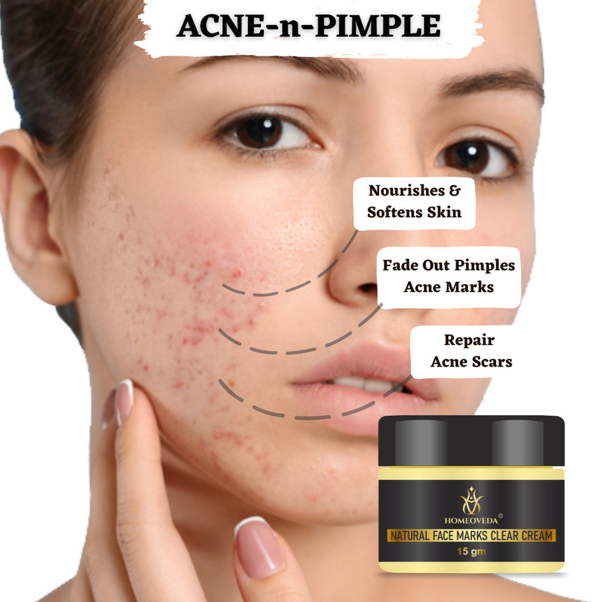 Face marks sales cream