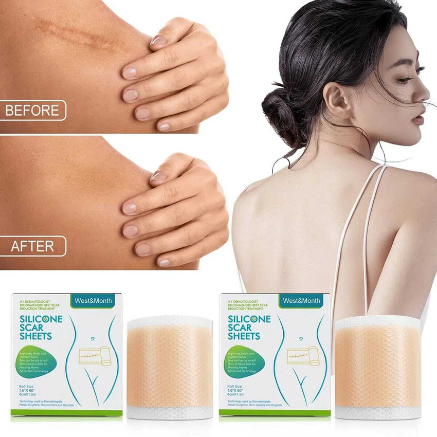 Scaraway silicone scar sheets discount