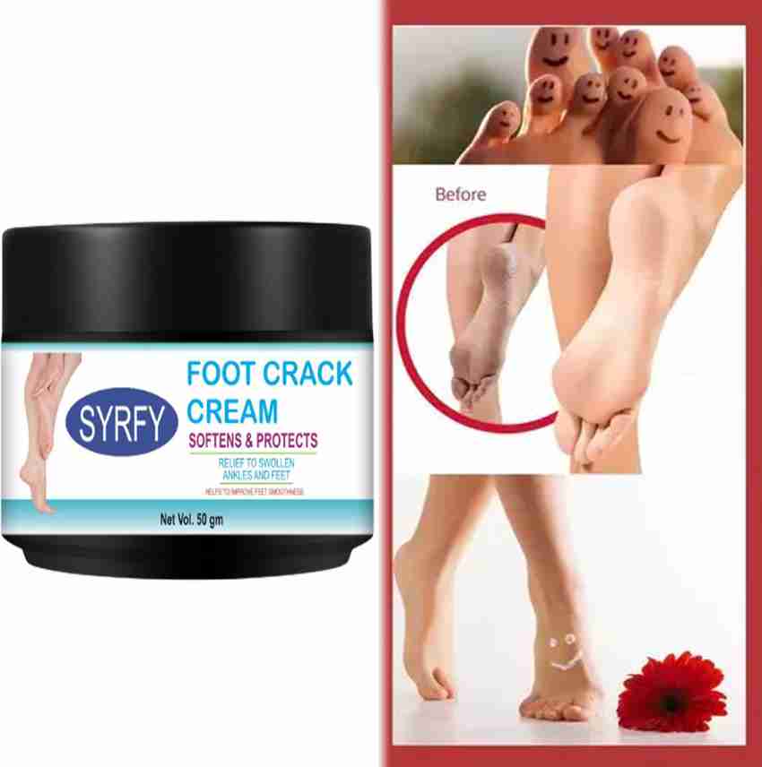 SYRFY Foot Crack Remover Cream For Women Men Price in India Buy SYRFY Foot Crack Remover Cream For Women Men online at Flipkart