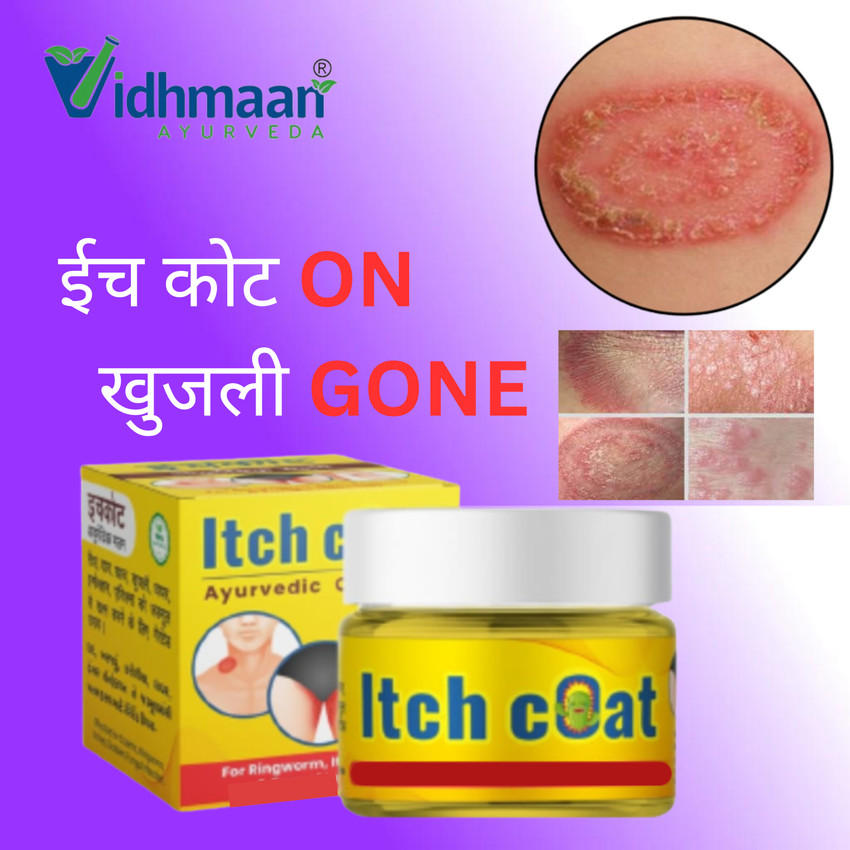 Aggregate more than 134 ring guard dawa xkldase.edu.vn