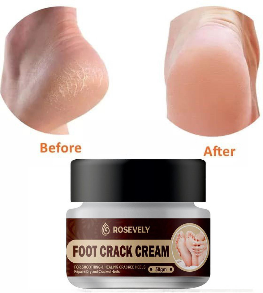 Natural foot cream new arrivals for cracked heels