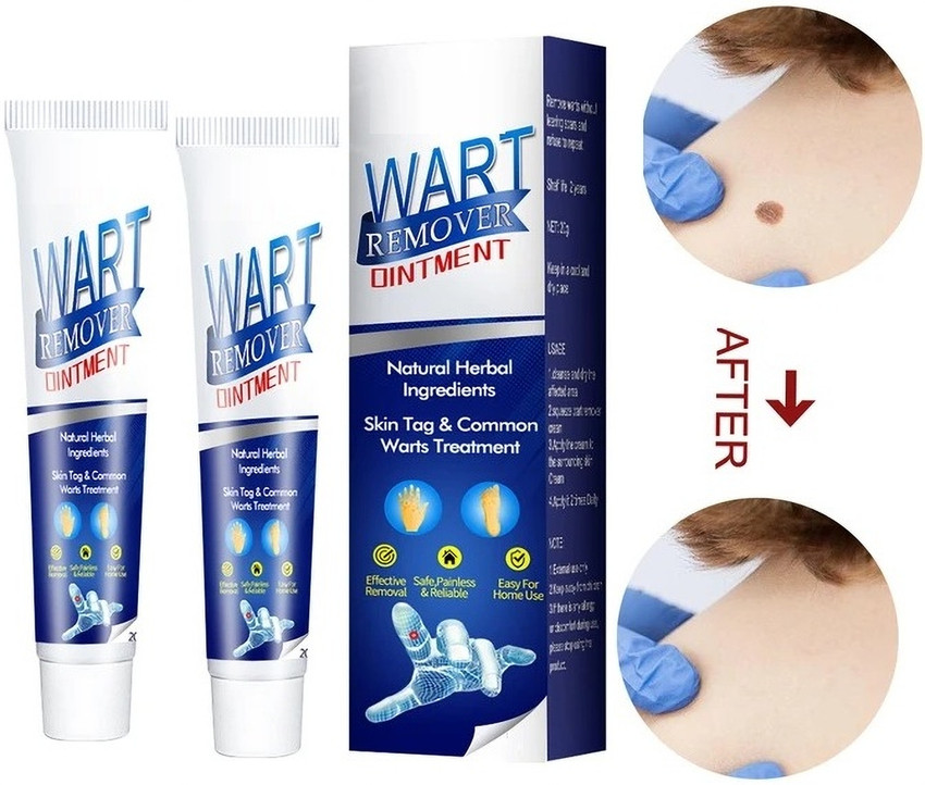 Best Wart Remover