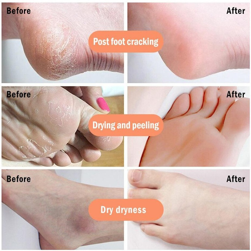 YAWI Crack Heel Repair Cream Smooth Foot Crack Cracked Heel Repair Foot Cream Price in India Buy YAWI Crack Heel Repair Cream Smooth Foot Crack Cracked Heel Repair Foot Cream Online