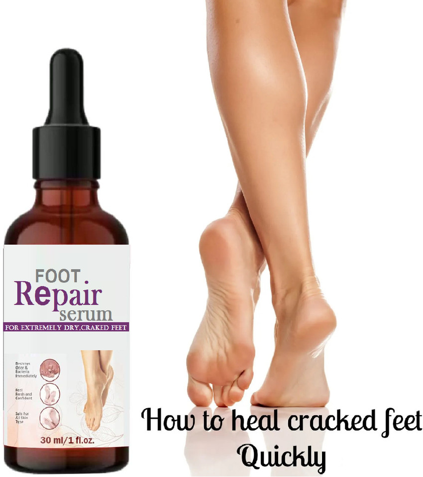 Foot crack ayurvedic treatment top