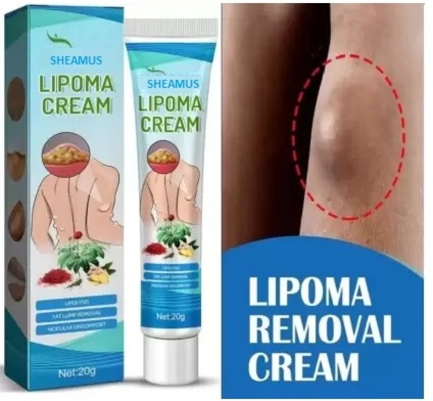 https://rukminim2.flixcart.com/image/850/1000/xif0q/cleanser/f/o/q/20-lipoma-removal-cream-for-extra-fat-on-any-body-part-20-g-original-imagrb9hywrnw7gr.jpeg?q=90