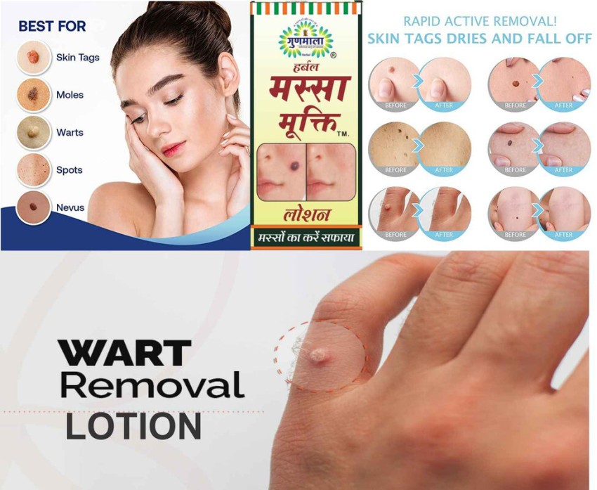 https://rukminim2.flixcart.com/image/850/1000/xif0q/cleanser/p/e/g/15-massa-mukti-effective-herbal-wart-removal-lotion-skin-or-mole-original-imagr558kdzkdyv7.jpeg?q=90