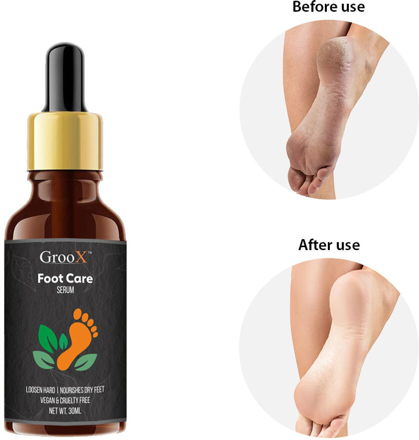 GrooX Herbal Foot Care Serum For Rough Dry Foot Foot Repair Serum Feet Soft Serum Price in India Buy GrooX Herbal Foot Care Serum For Rough Dry Foot Foot Repair Serum