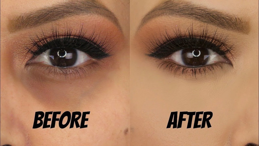 Best concealer to top hide dark circles