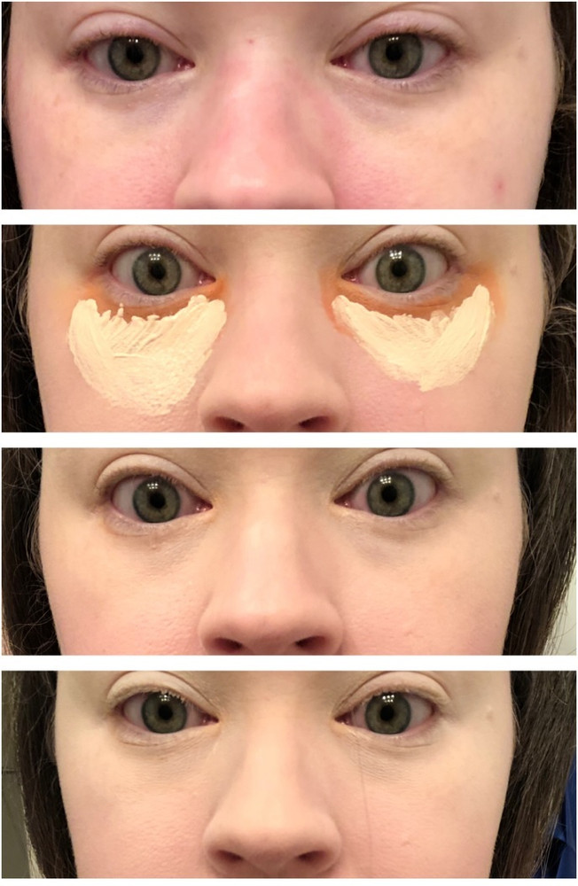 BLUEMERMAID SMUDGEPROOF YELLOW CONCEALER FOR DARK PATCHES