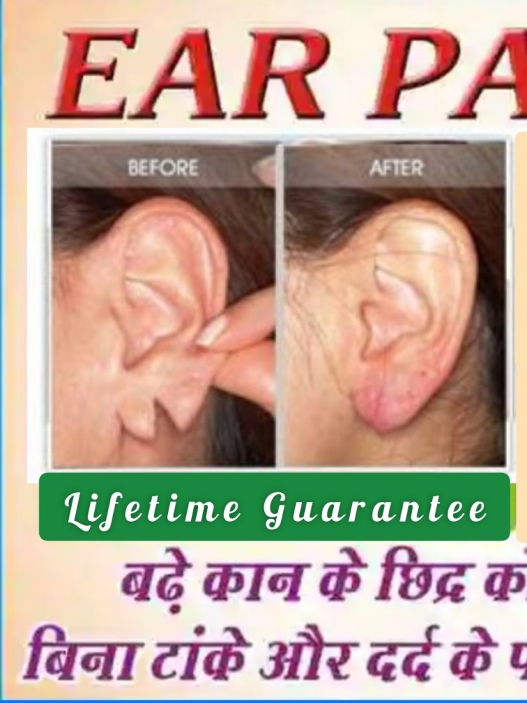 Lobe Wonder Reusable Ear Lobe Support Price in India - Buy Lobe