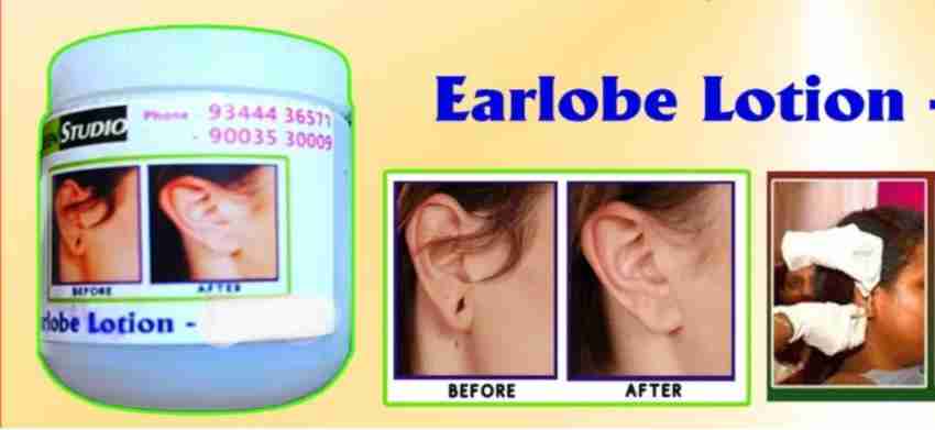 eyurva Disposable Ear Lobe Support Price in India - Buy eyurva