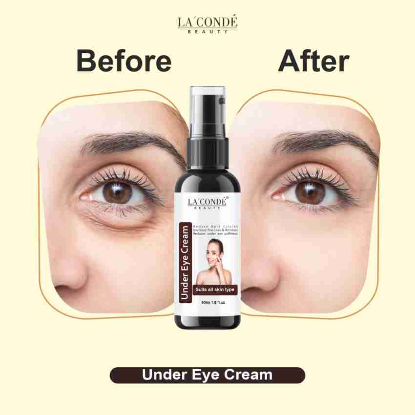 La Conde Under Eye Cream to Remove Dark Circles Wrinkles