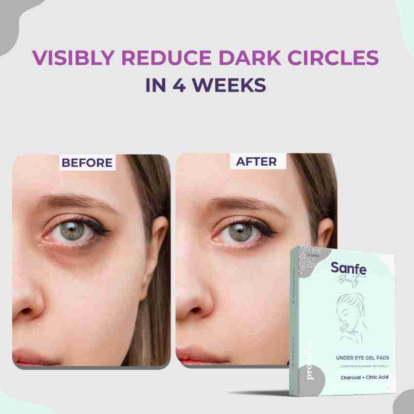 Bags And Swelling Eye Contour Gel Mask
