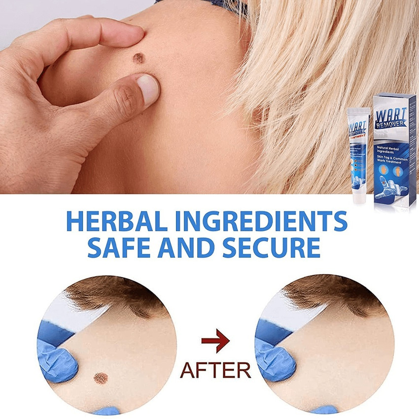 GULGLOW99 WartsOff Instant Blemish Removal Cream Price in India Buy GULGLOW99 WartsOff Instant Blemish Removal Cream Online In India Reviews Ratings Features Flipkart
