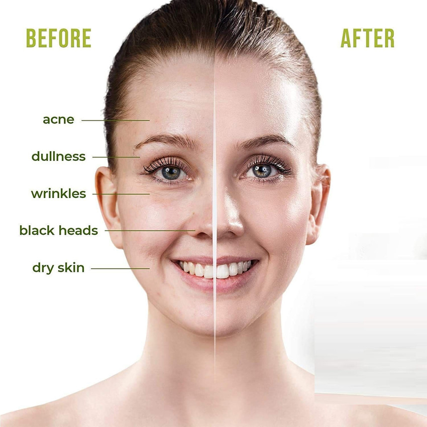 Face dead on sale skin remover