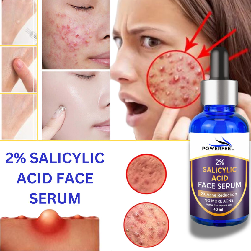 POWERFEEL 2 Salicylic Acid Face Serum Fights Acne Marks for Active Acne All Skin Type Price in India Buy POWERFEEL 2 Salicylic Acid Face Serum Fights Acne Marks for