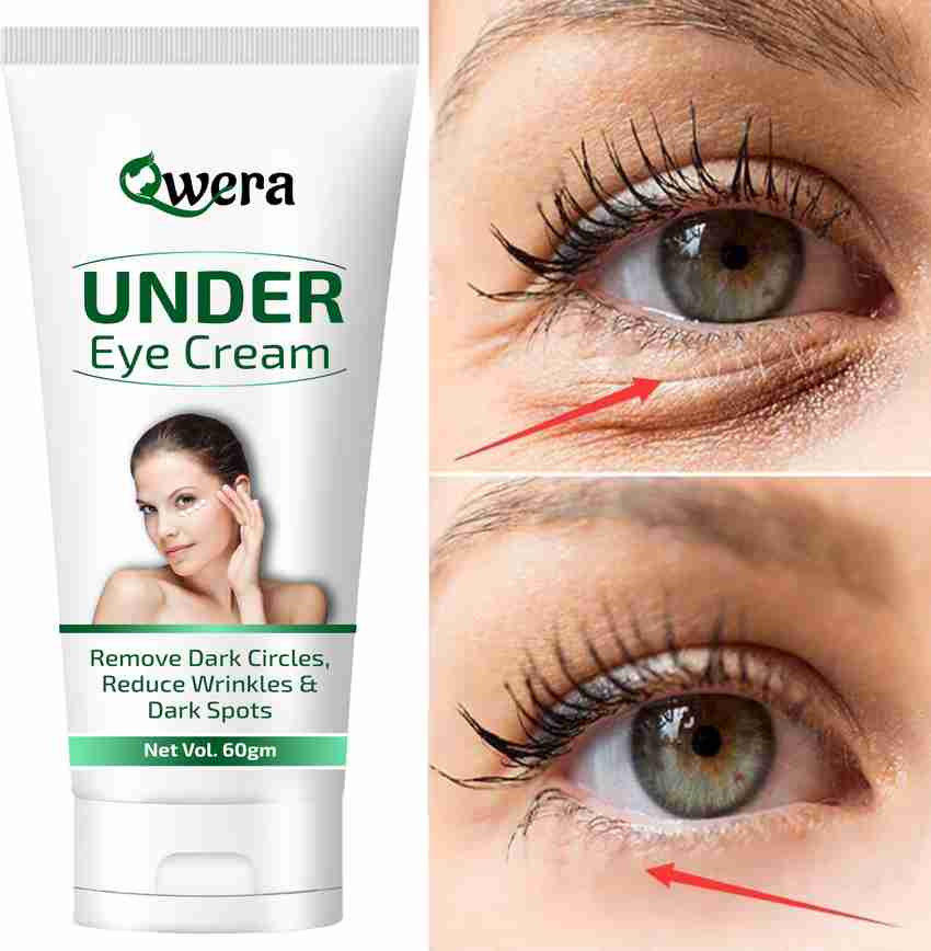 Dark circles remover deals cream