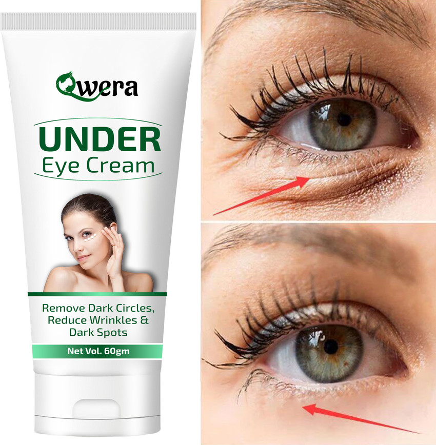 Eye dark shop circles removal cream