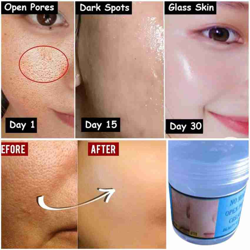 TRZ Bye Bye Open Pores Face Cream Skin Whitening Gel Price in