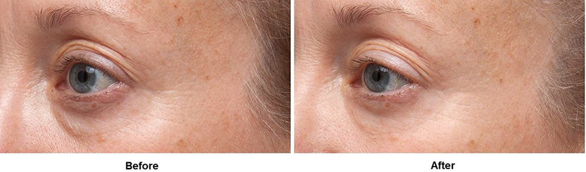 Dr dennis shop gross eye cream