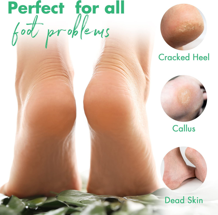 Rough heel discount skin remover