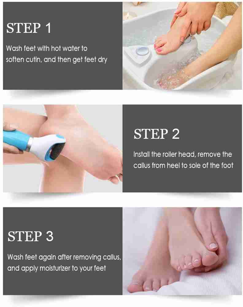 Best tool for removing dead skin from feet clearance