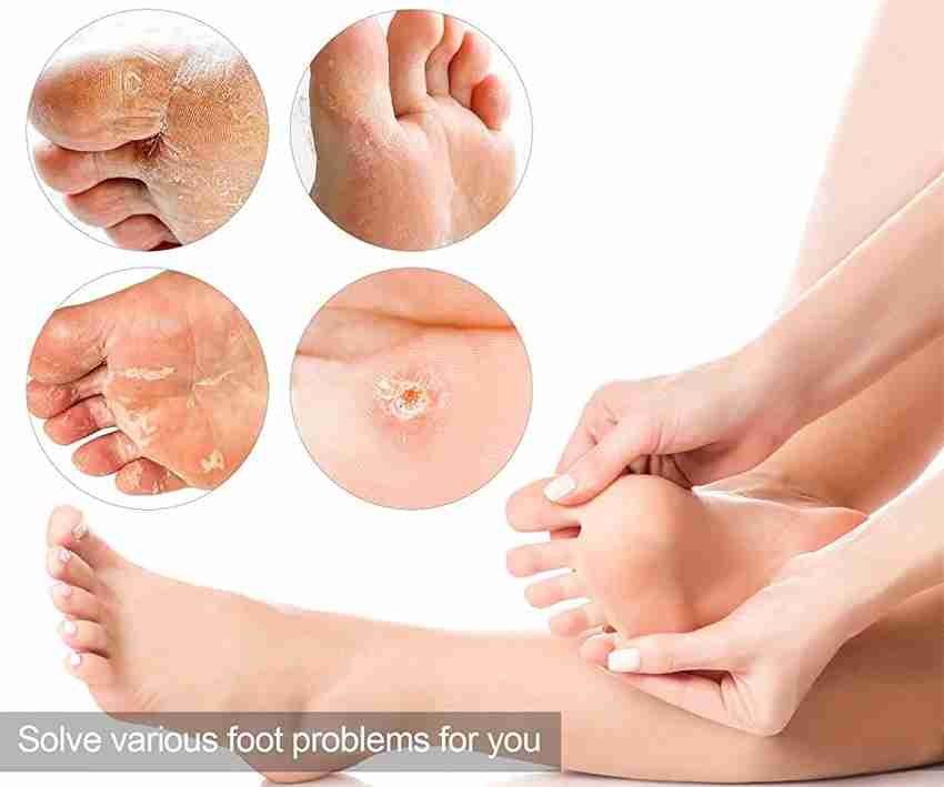 MYEONG Pedicure Tools Foot Corn Removal Dead Skin Remover Price in India Buy MYEONG Pedicure Tools Foot Corn Removal Dead Skin Remover Online In India Reviews Ratings Features Flipkart