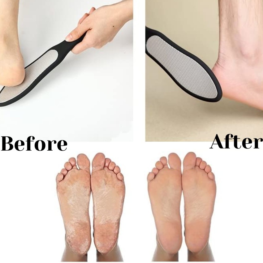 https://rukminim2.flixcart.com/image/850/1000/xif0q/foot-filer/m/e/0/foot-scrubber-for-pedicure-nickel-plate-n-emery-pad-for-hard-original-imagkfyzhzkztzum.jpeg?q=90