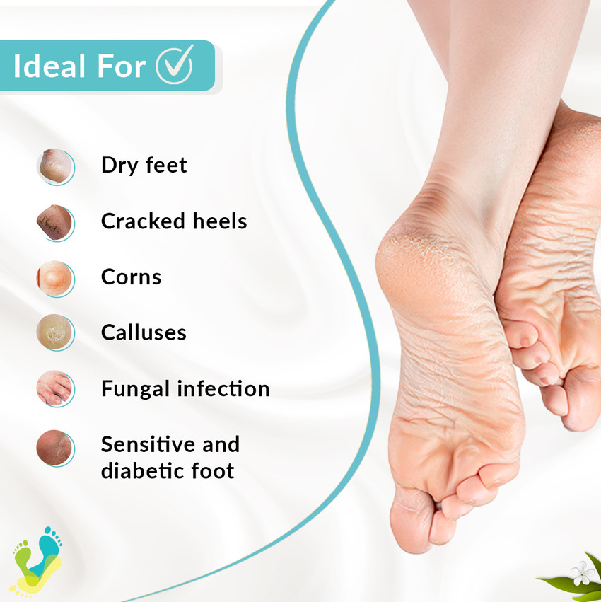 Update more than 130 reason for dry cracked heels latest jtcvietnam