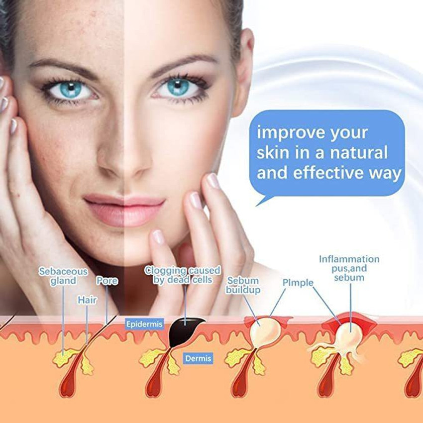 Galvanic Energy Treatment—Benefits, Risks, Cost, And