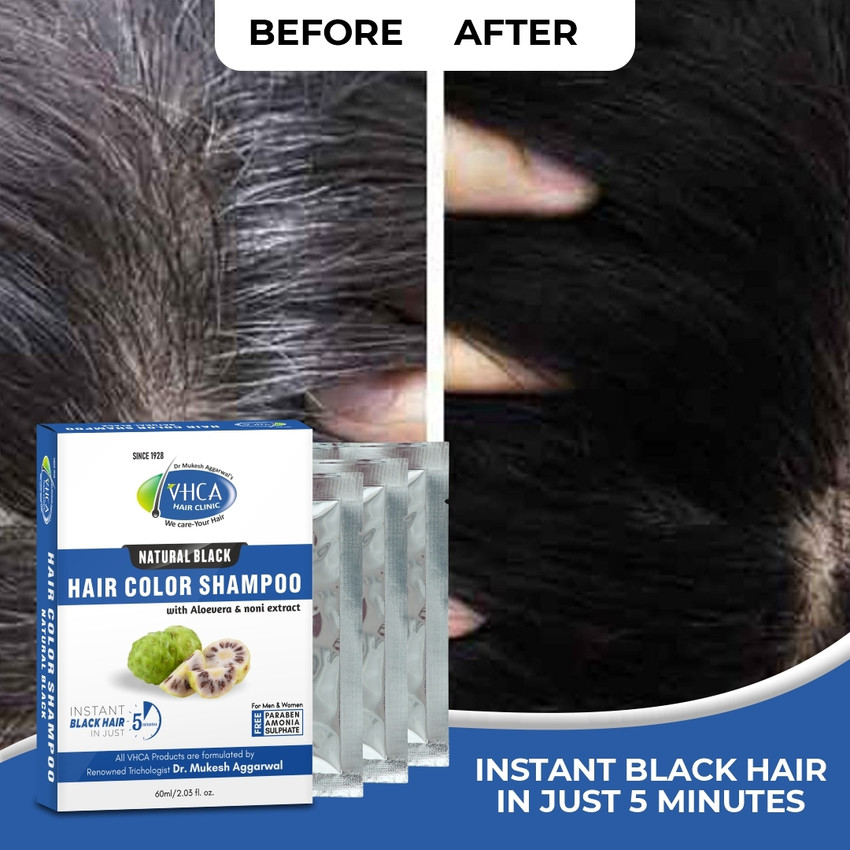 Aggregate 137+ vhca hair clinic ceg.edu.vn