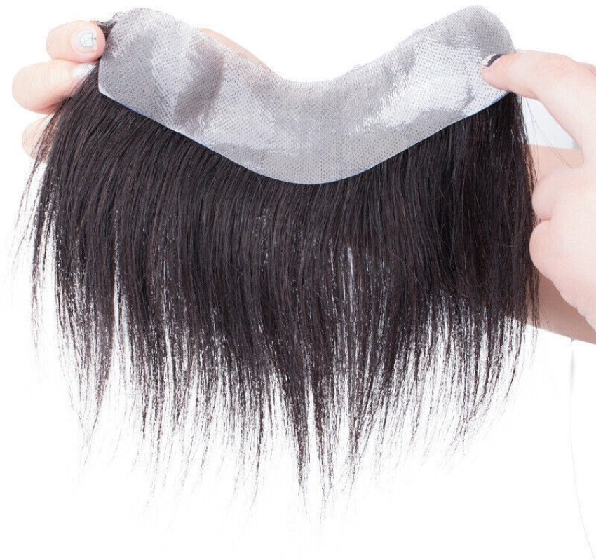 Hair Patch In Delhi - Process, Cost, Success Rate, Time, Results